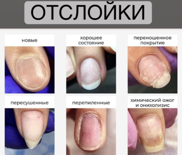 [Вельмитина Зайцева] Отслойки (2021)_0.jpg